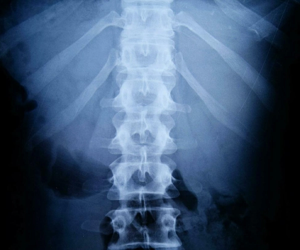 Professional Physiotherapy Care for Spine And Joint Recovery